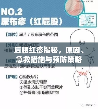 后腰红疹揭秘,原因、急救措施与预防策略