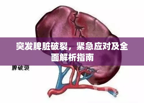 突发脾脏破裂,紧急应对及全面解析指南