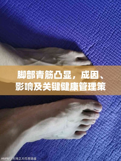 脚部青筋凸显,成因、影响及关键健康管理策略